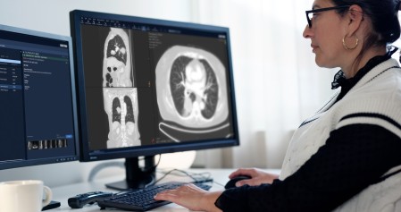 PACS based reporting image.jpg